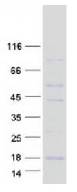 SDS-PAGE (RBX1-969H).jpg